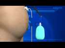 FDA approves ‘abdominal vomiting’ weight-loss device