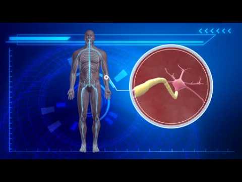 New evidence links Zika virus to neurological disorders