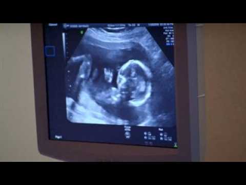 My Own Man - bande annonce - VOST - (2014)