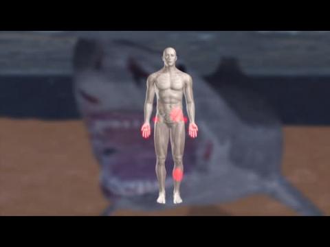 Man bitten by shark while swimming off North Carolina coast