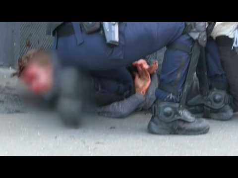 Images of an injured man being detained during yellow vest protest in Paris